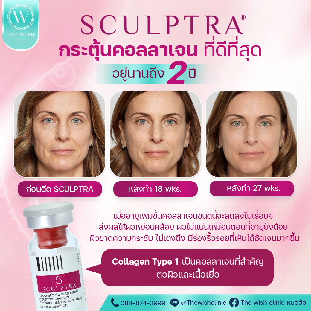 sculptra