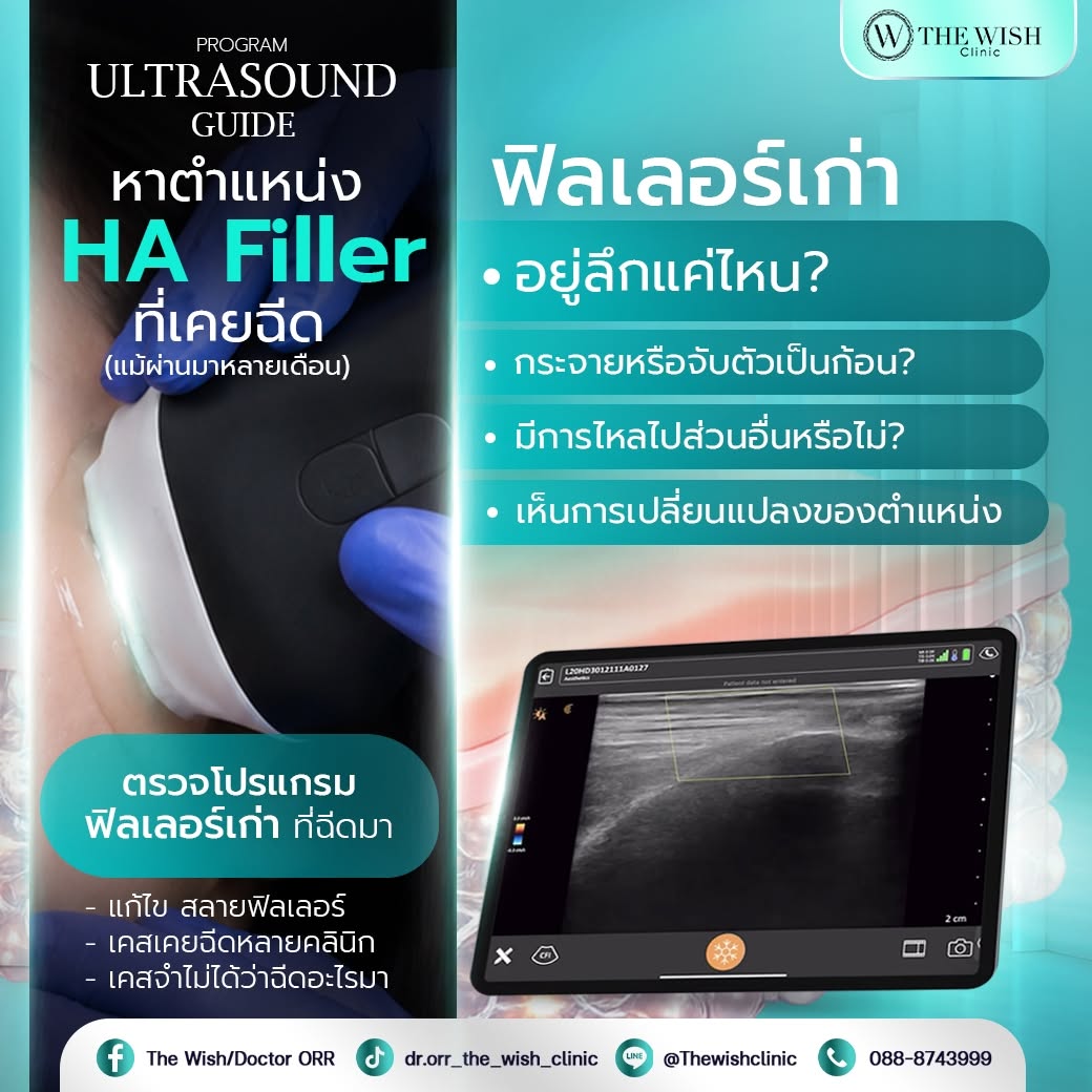 ultrasound