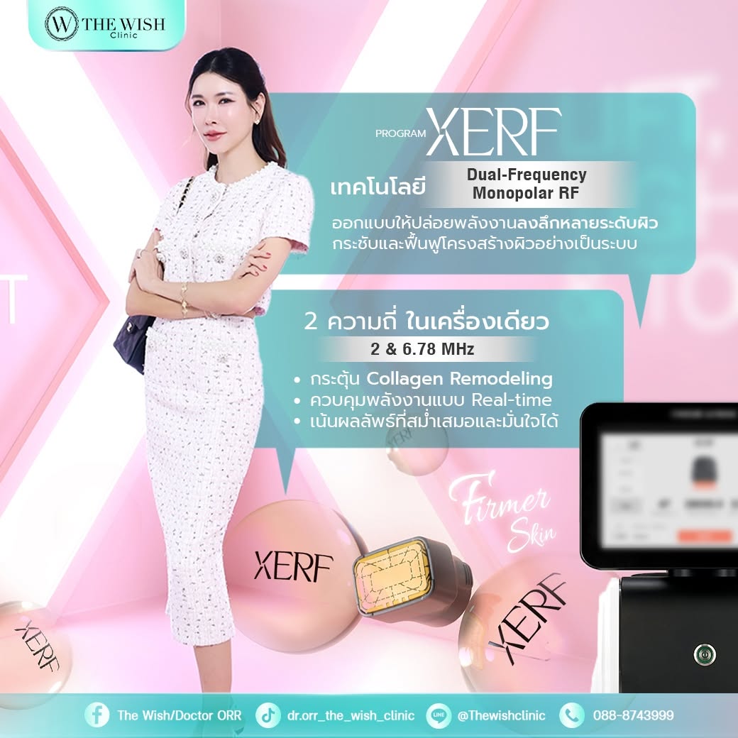 XERF