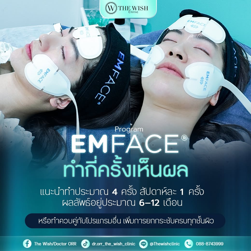 emface