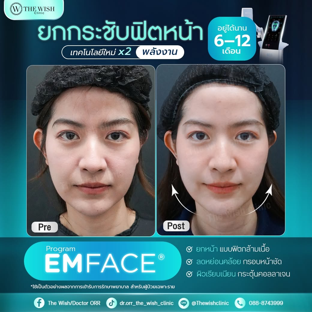 emface