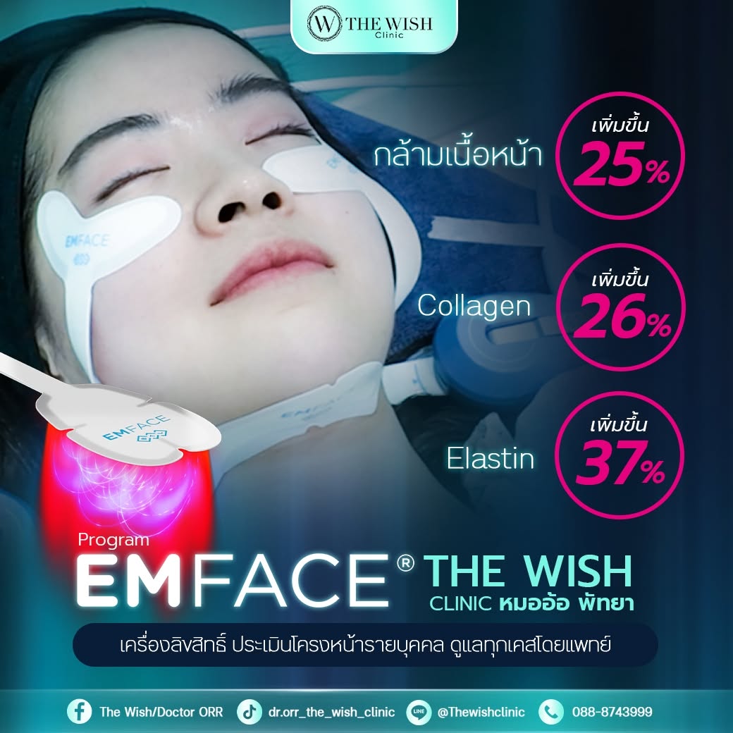 emface