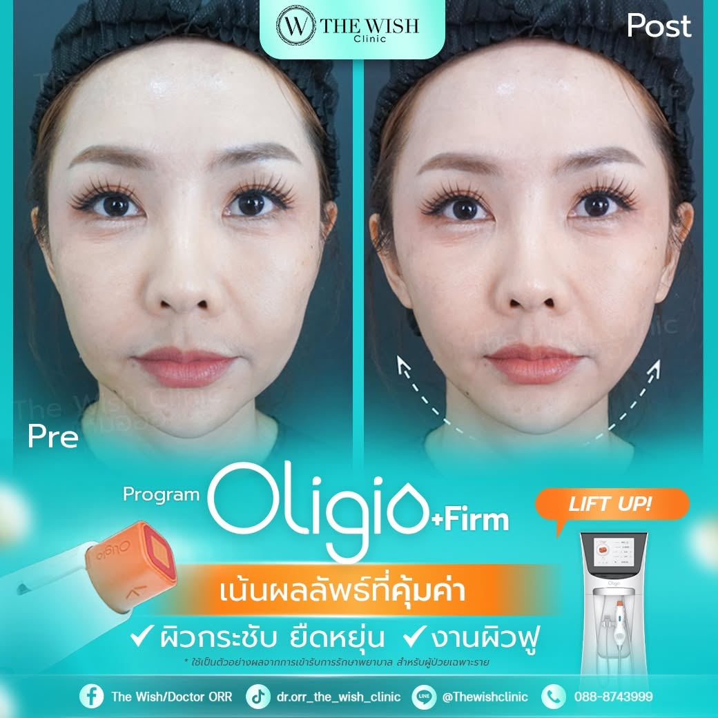 oligio plus firm