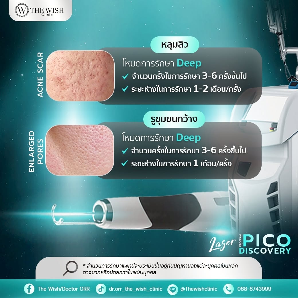 pico discovery