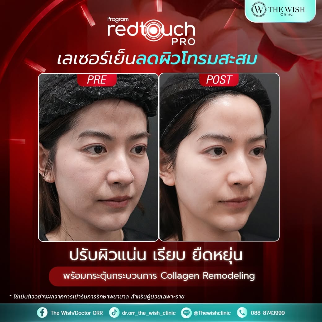 redtouch pro