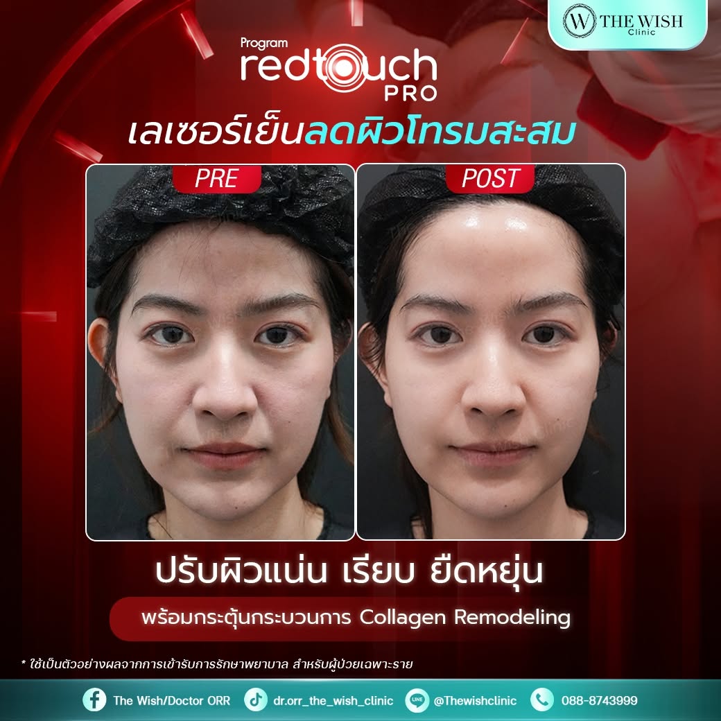 redtouch pro