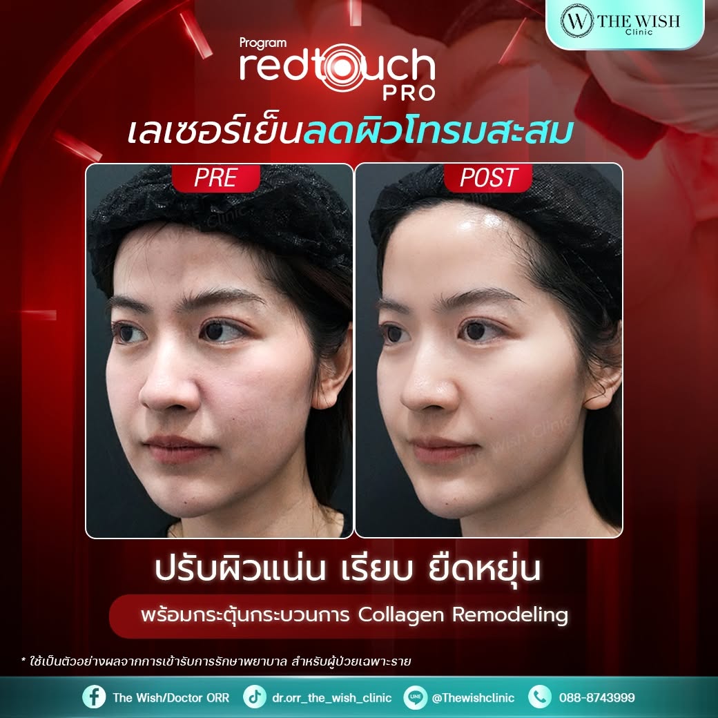 redtouch pro