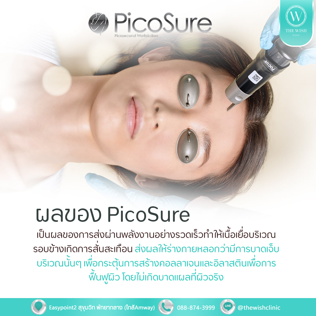 picosure