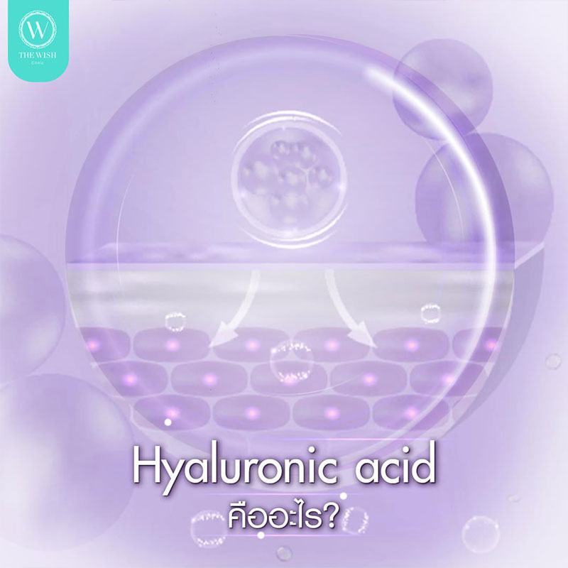 Hyaluronic-Acid