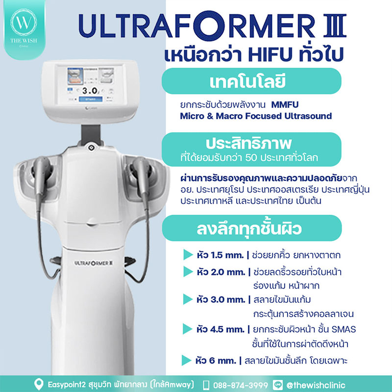 ULTHERAPY