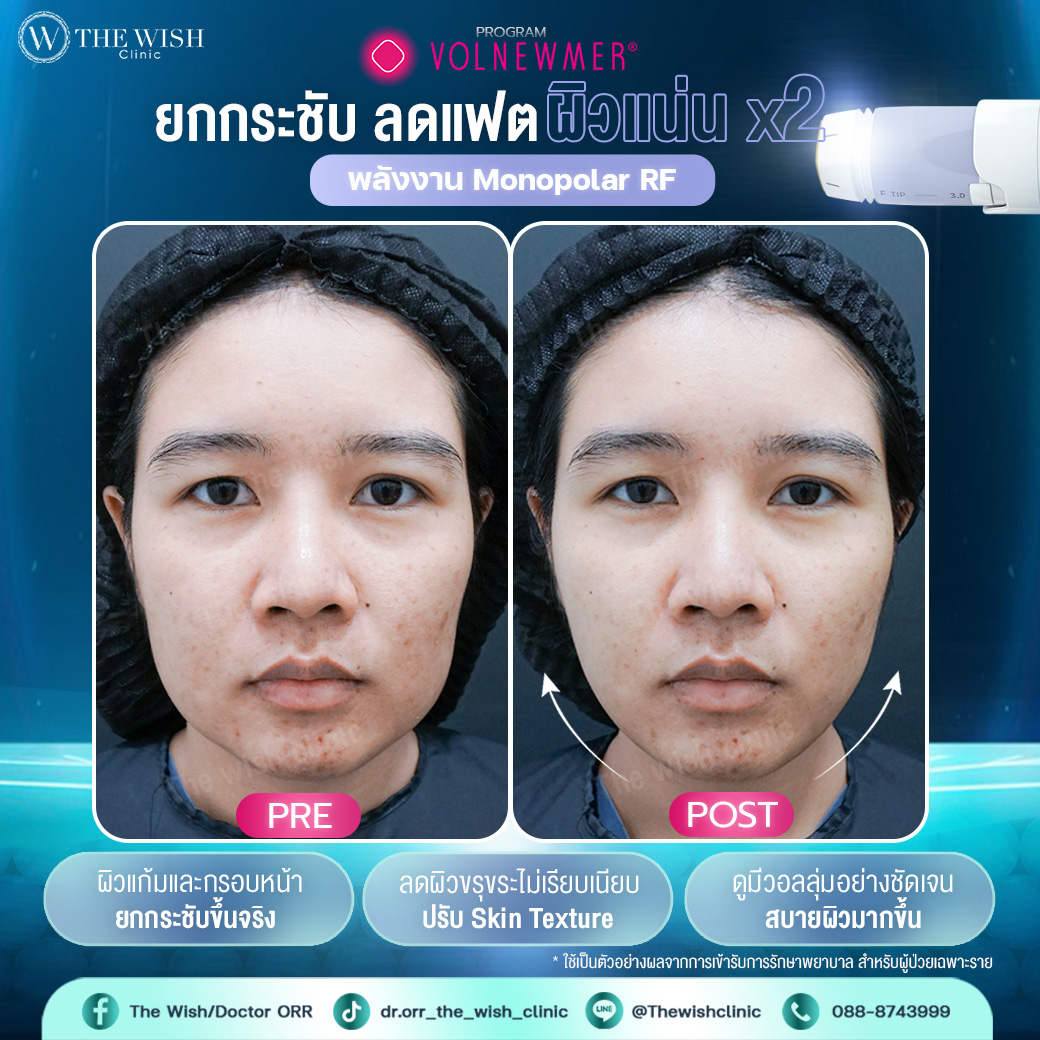 Volnewmer