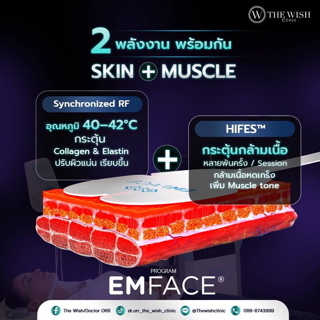 emface