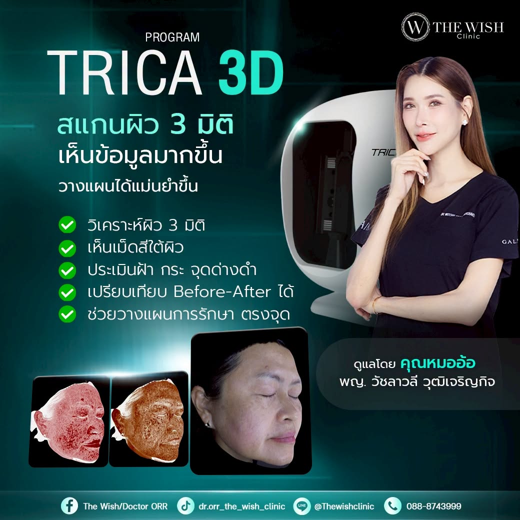 trica 3d