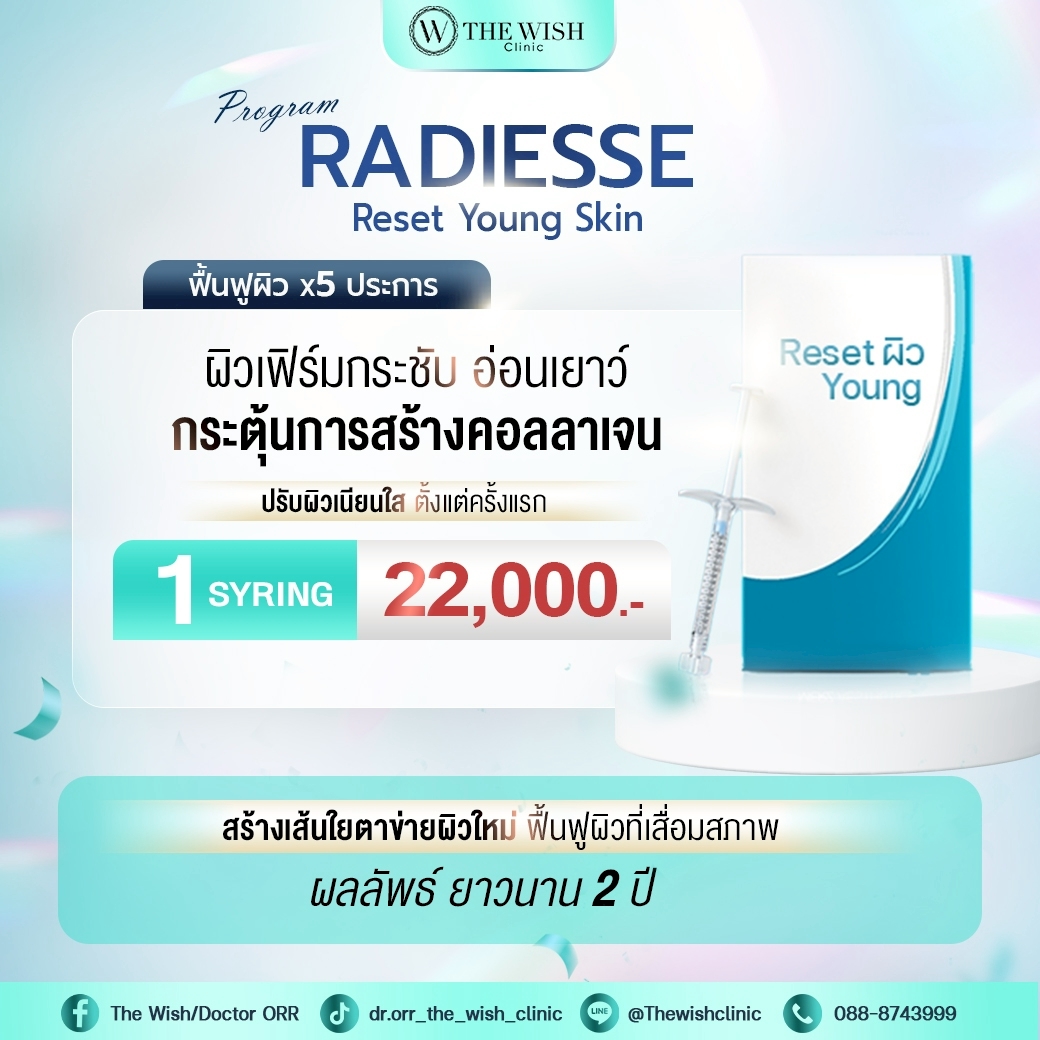 RADIESSE