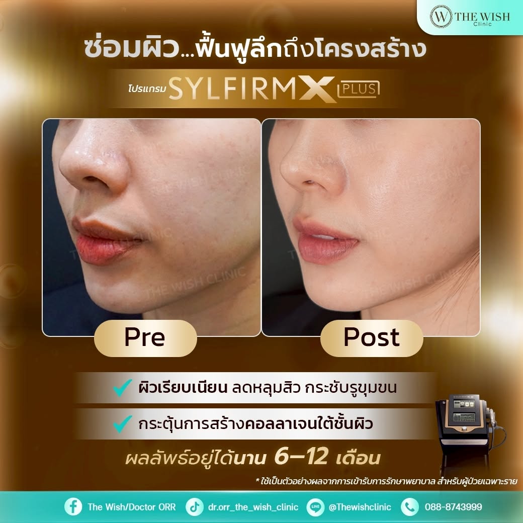 sylfirm