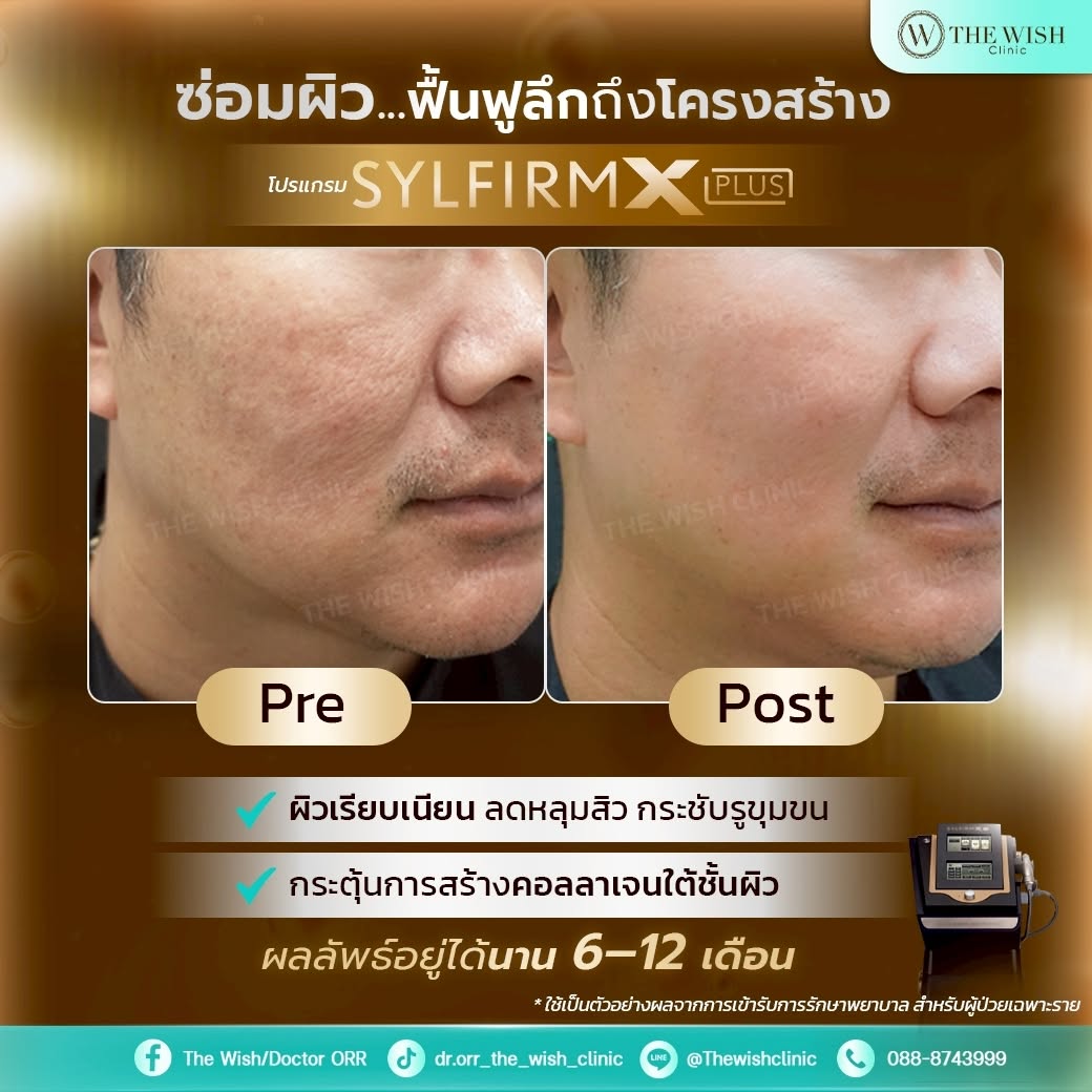 sylfirm