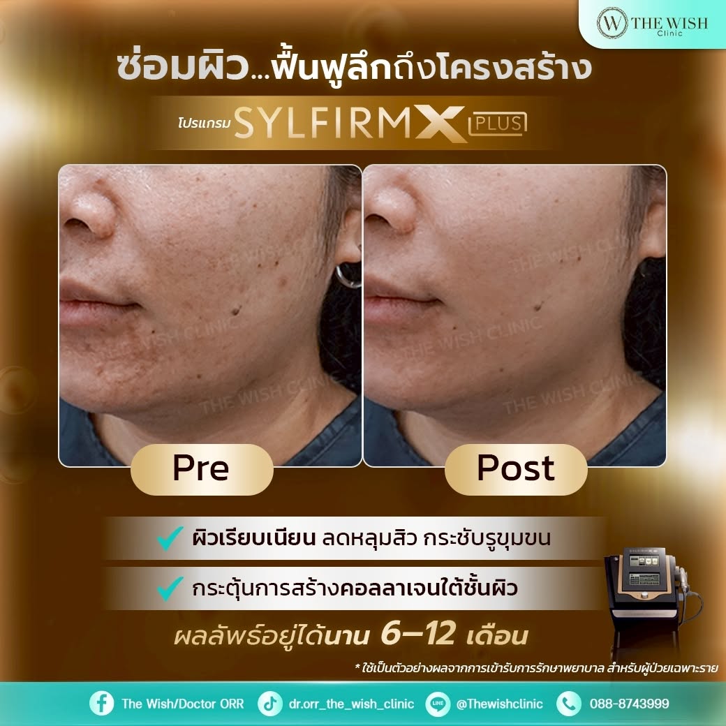 sylfirm