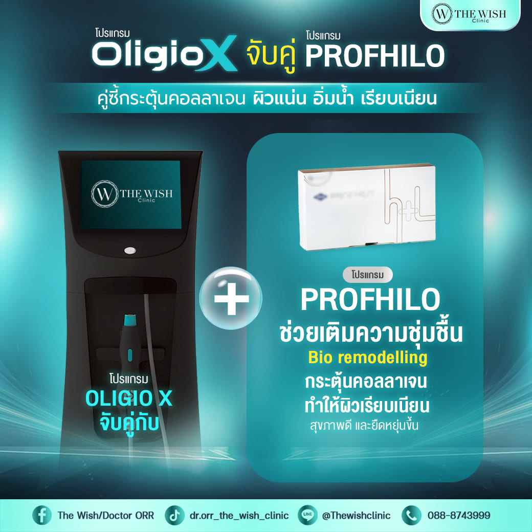 oligo x