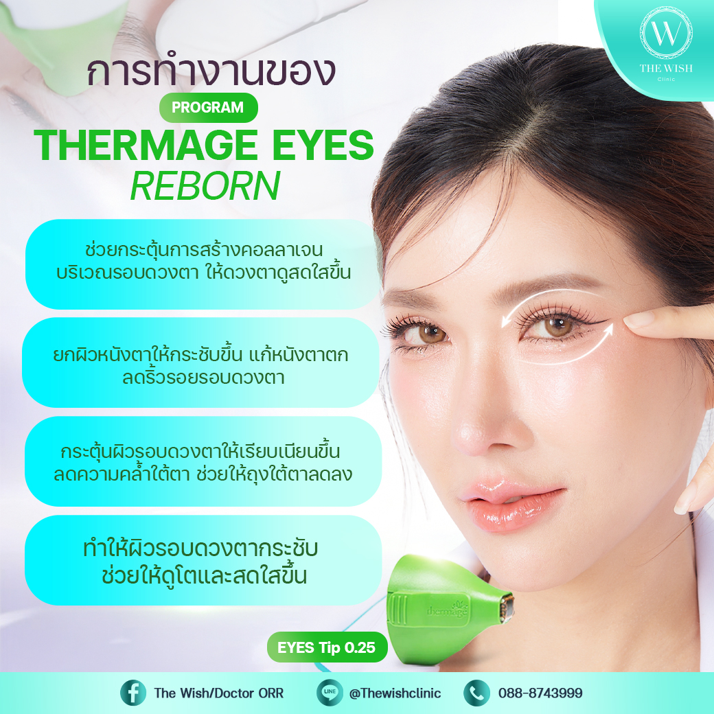 thermage