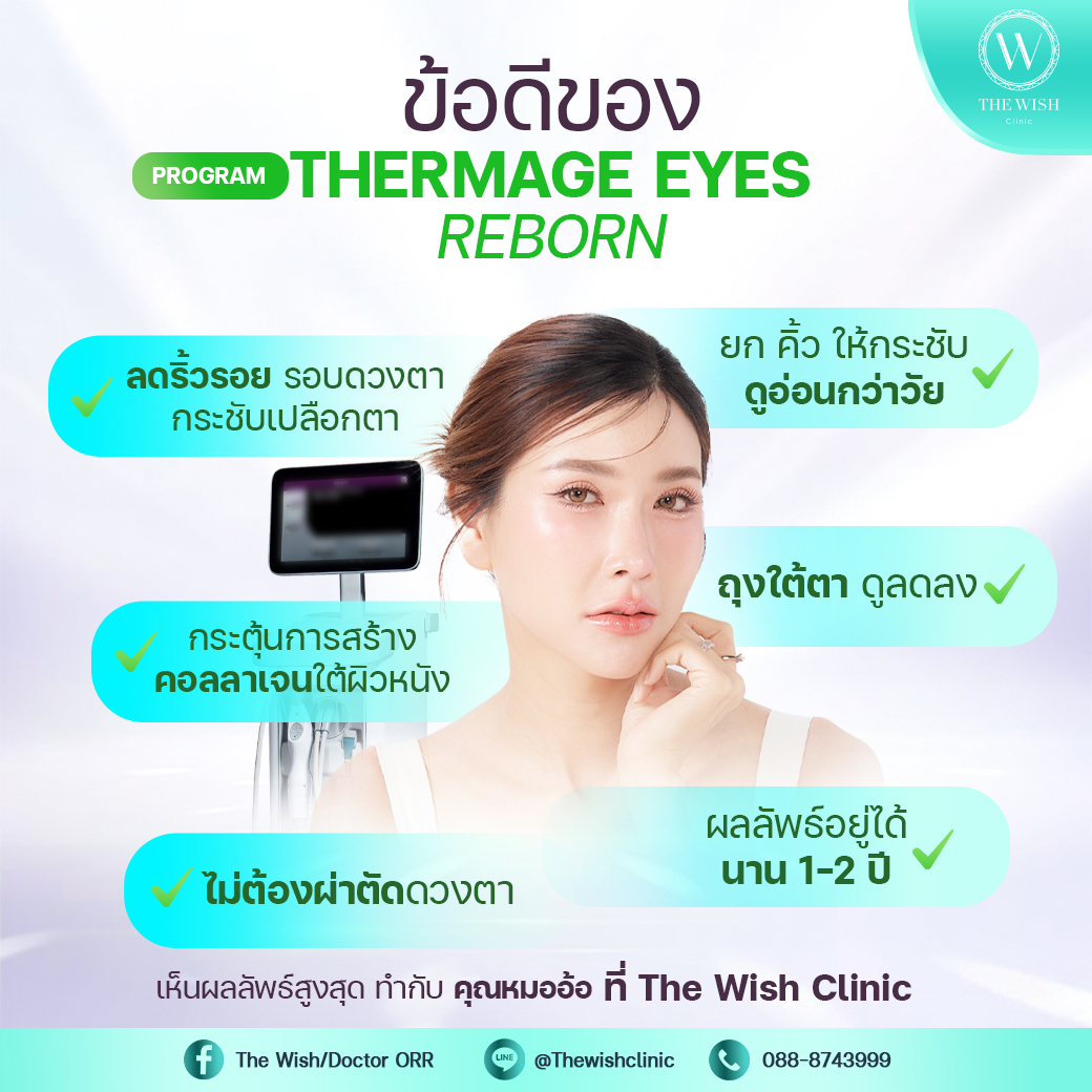 thermage