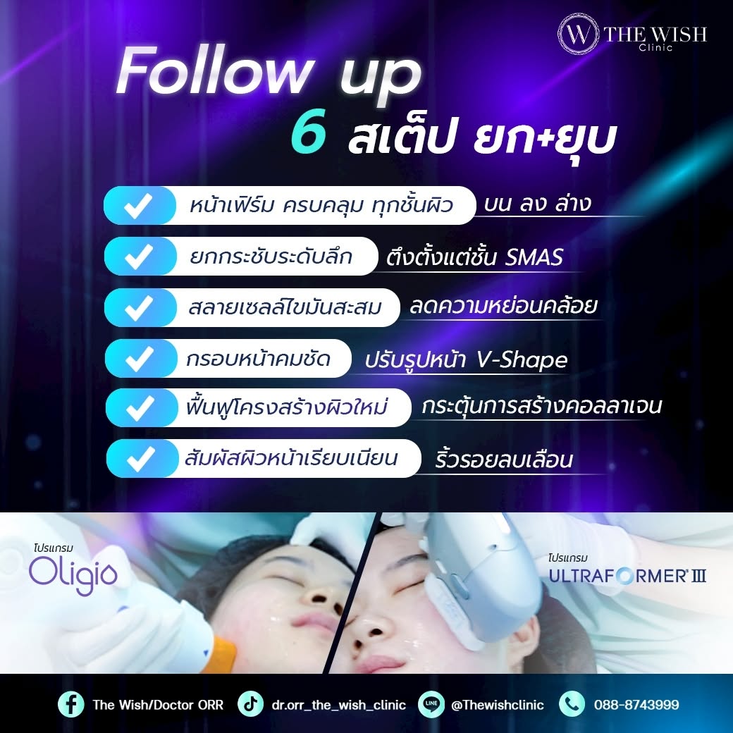 Oligo