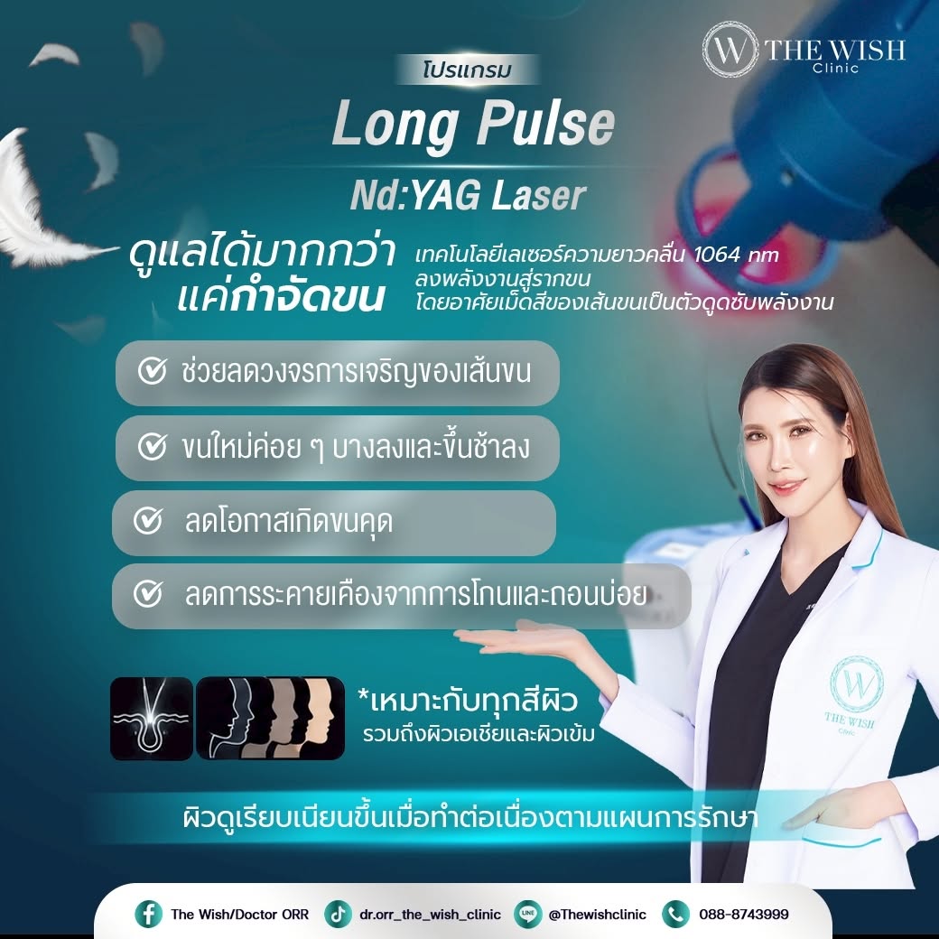 longpulse nd yag