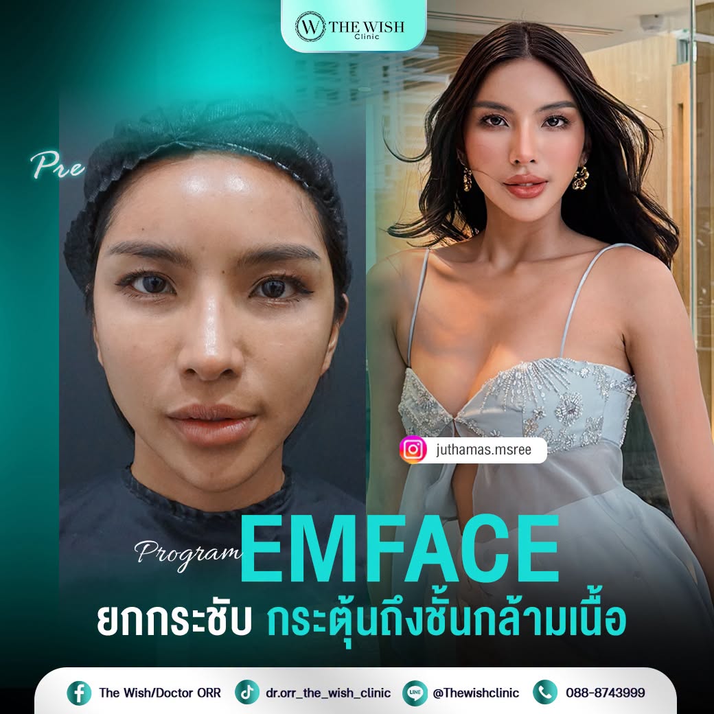 emface
