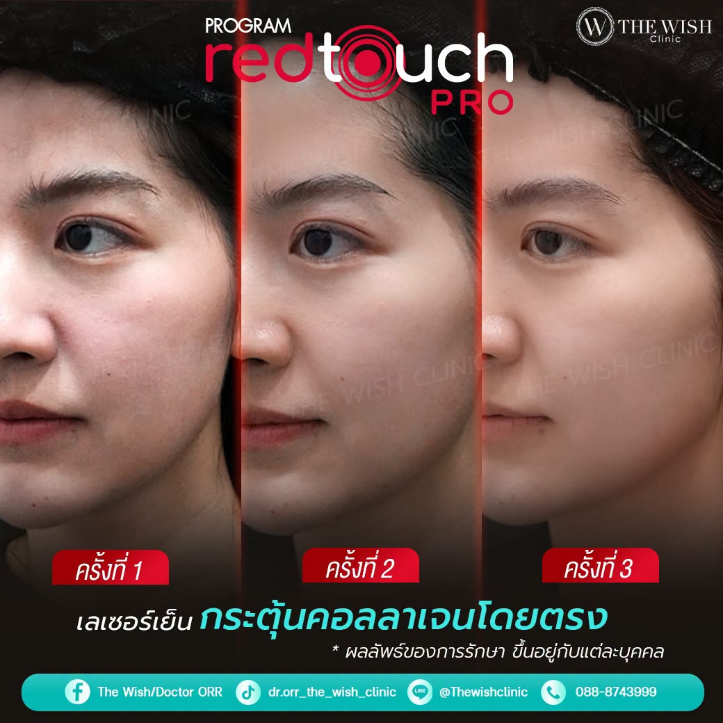 redtouch pro