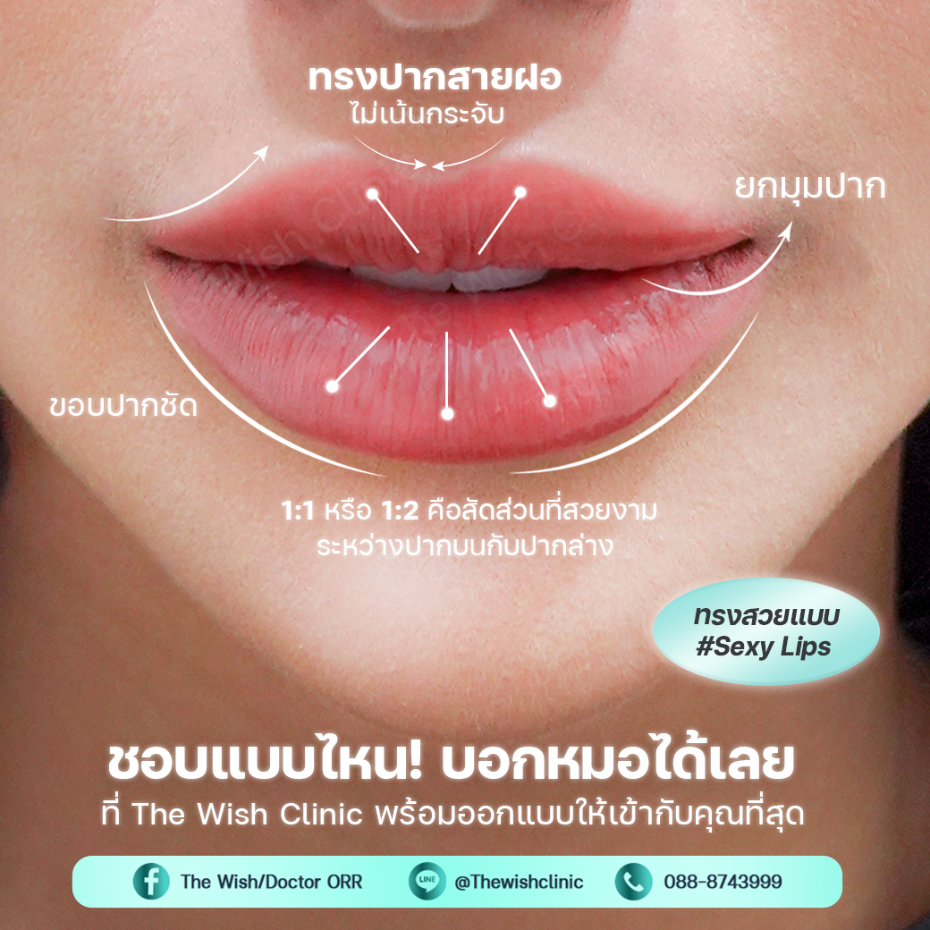 filler lip