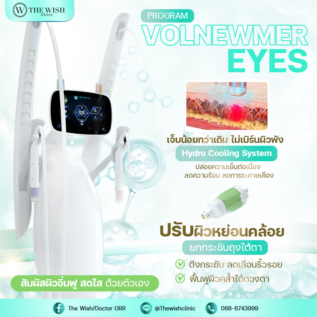 Volnewmer