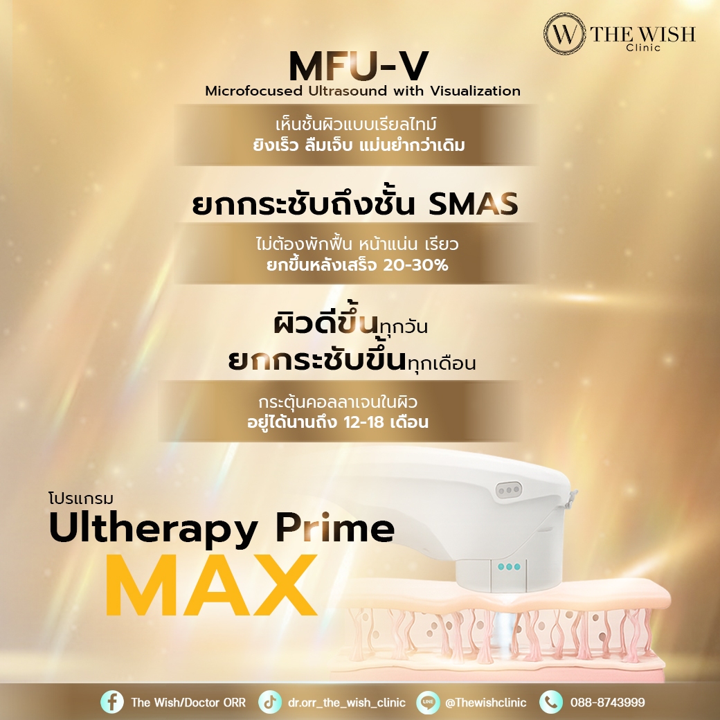 ultherapy prime