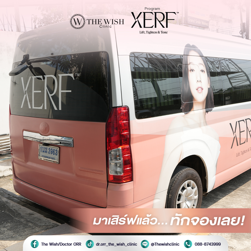 XERF