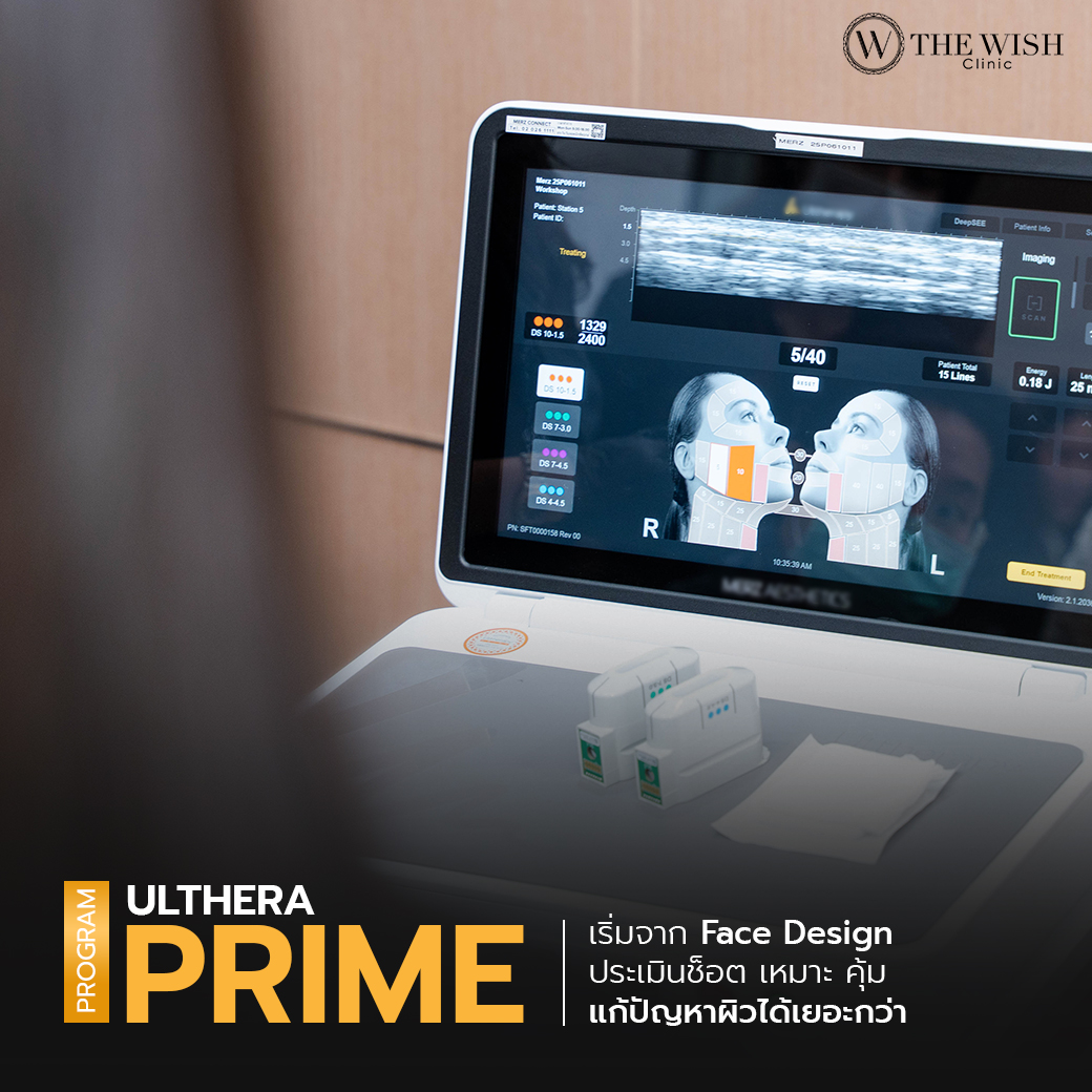ultherapy prime