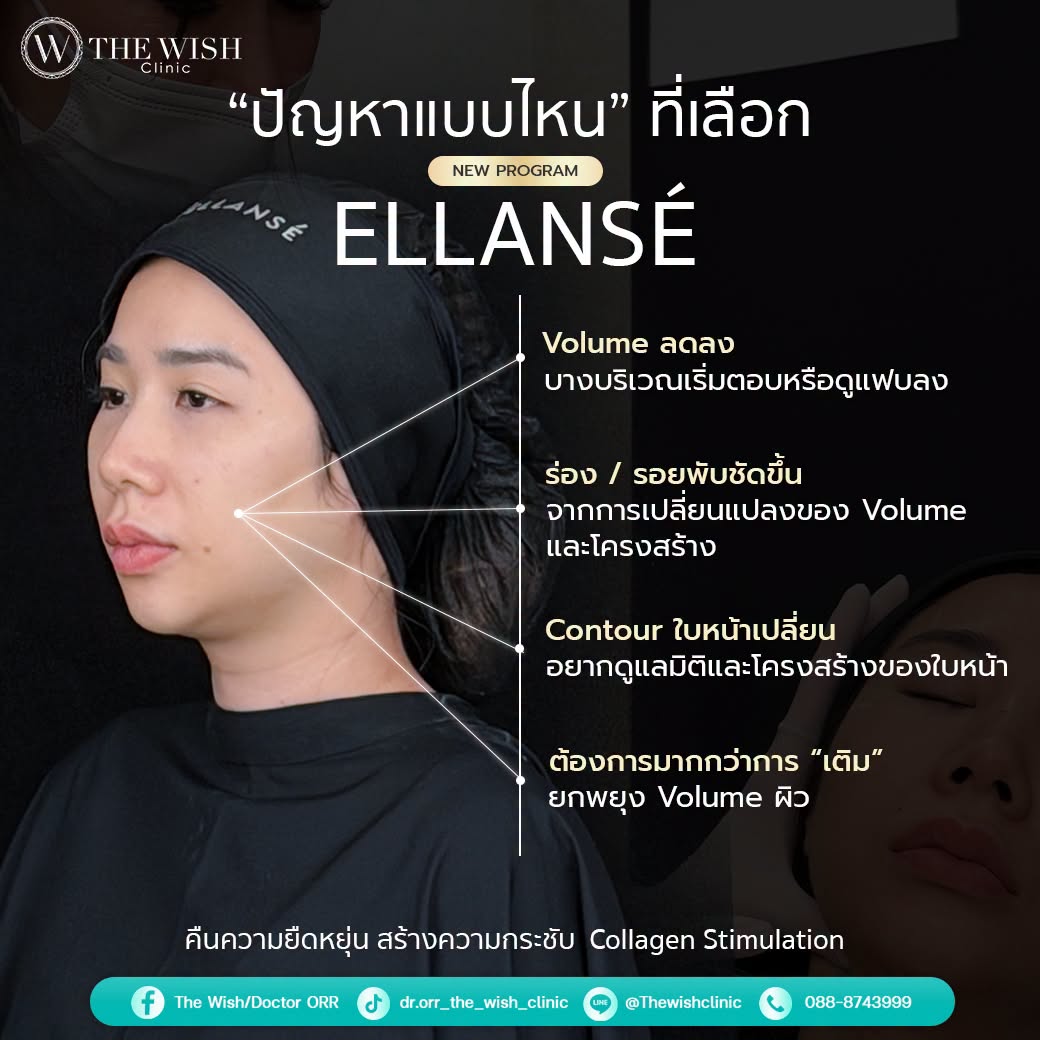 ELLANSÉ