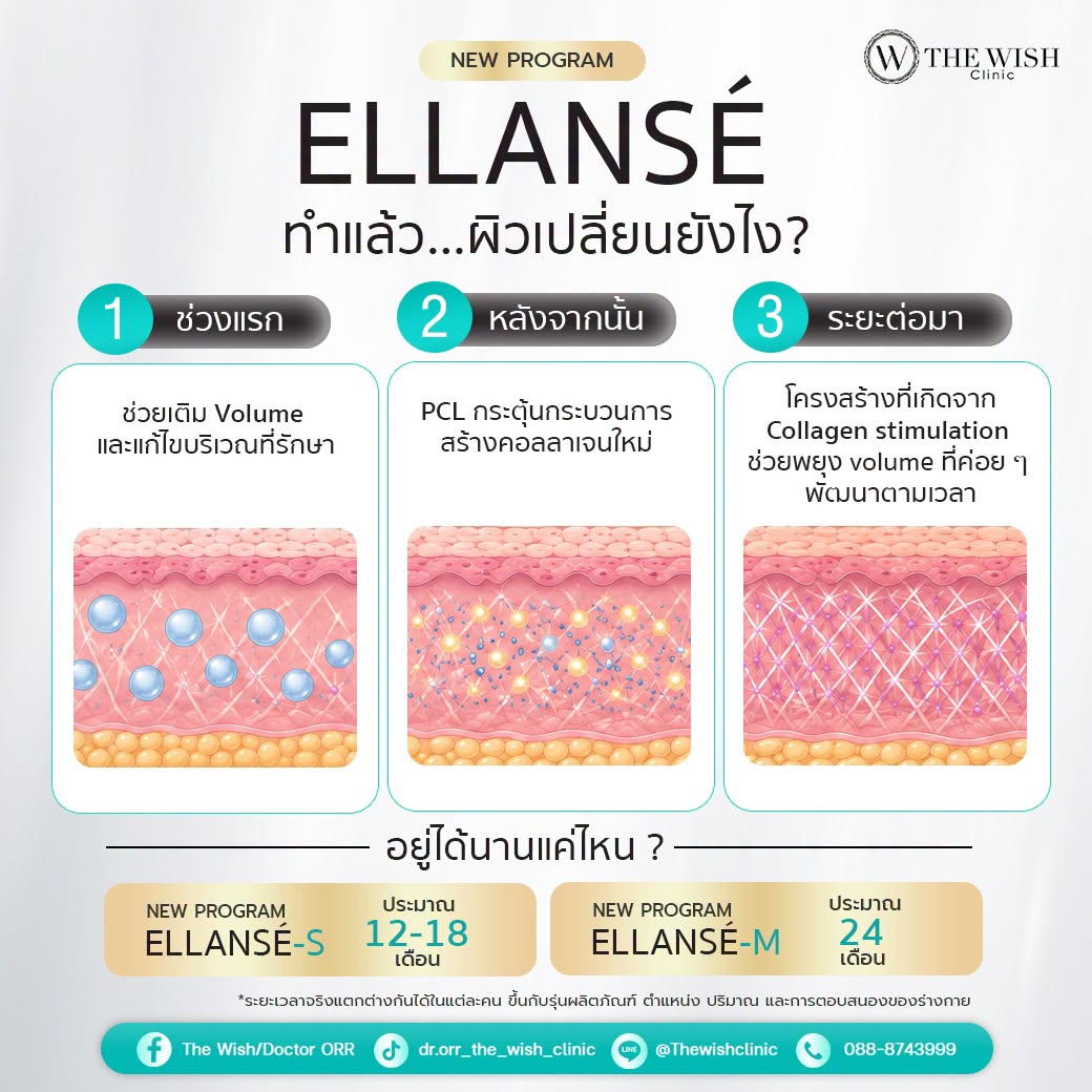 ELLANSÉ