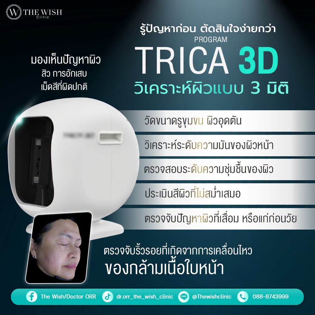 trica 3d