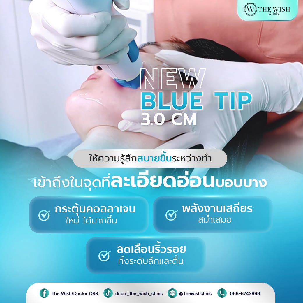 thermage flx