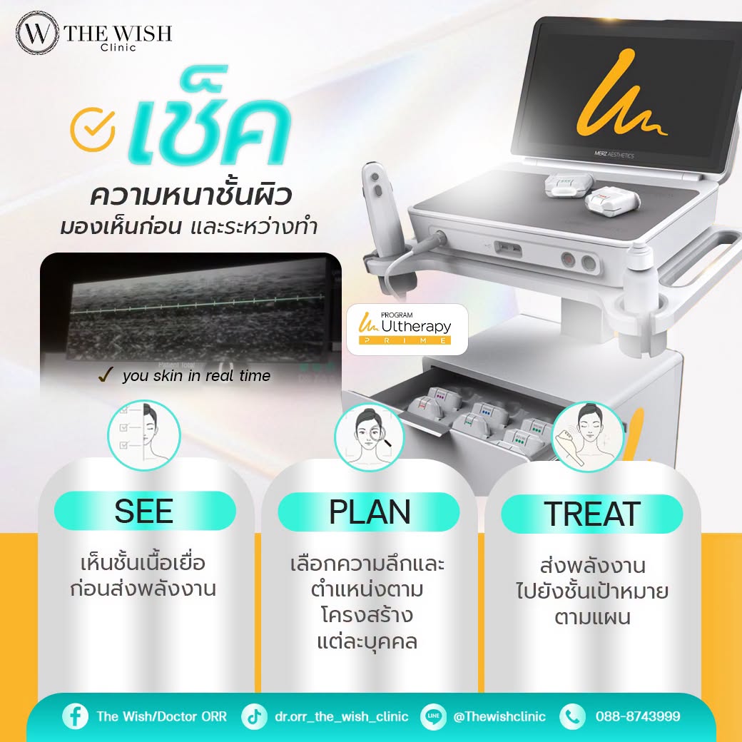 ultherapy prime
