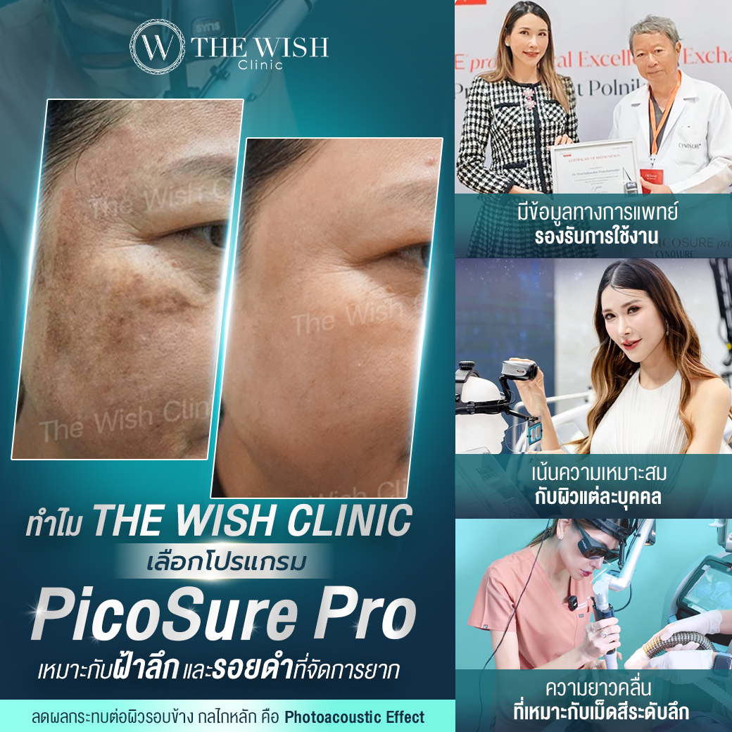 picosure pro
