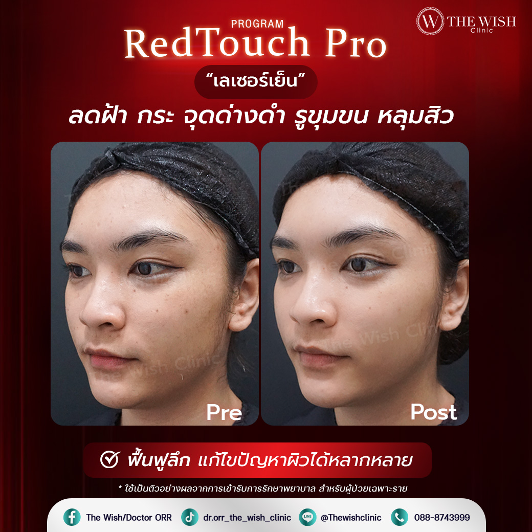 retouch pro