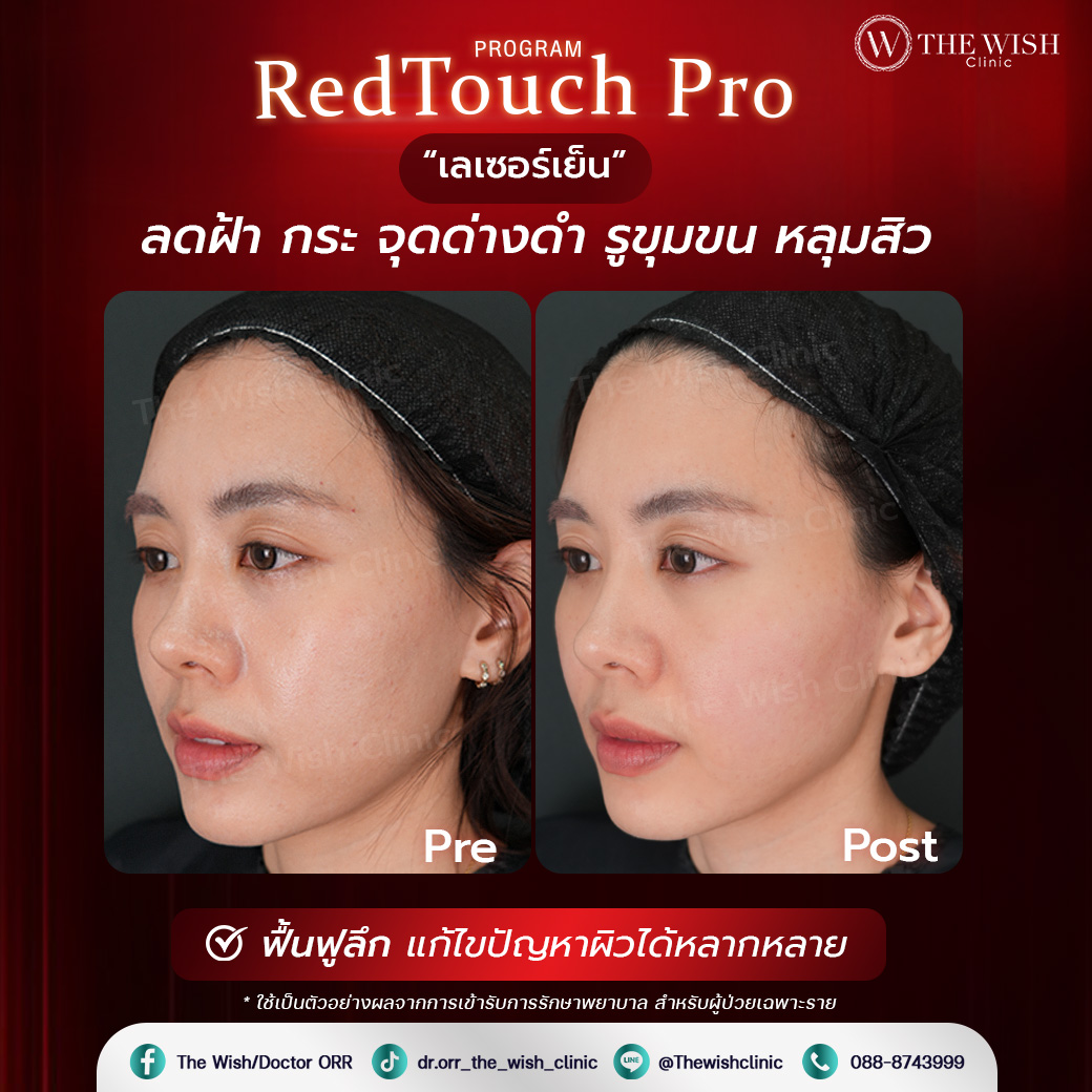 retouch pro