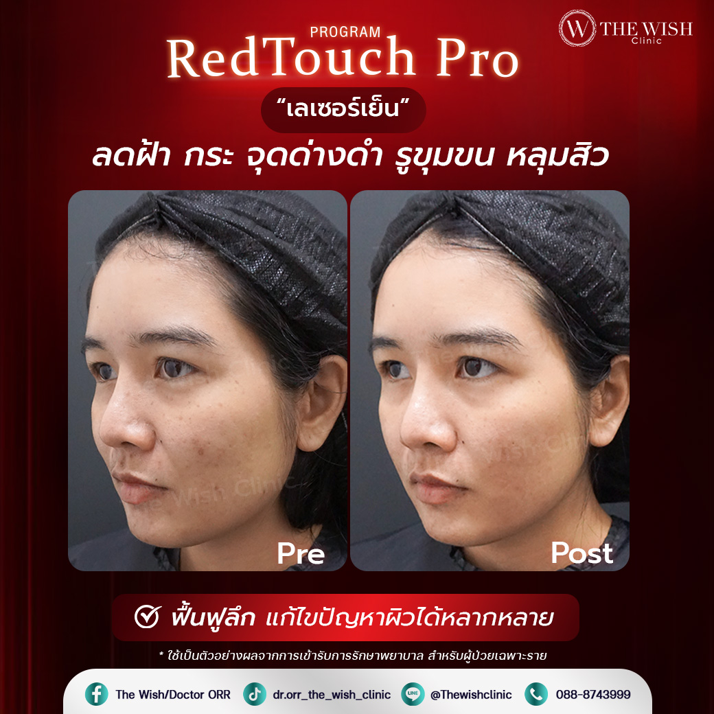 retouch pro