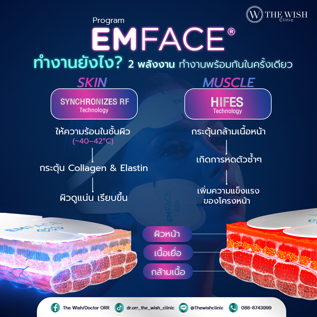 emface