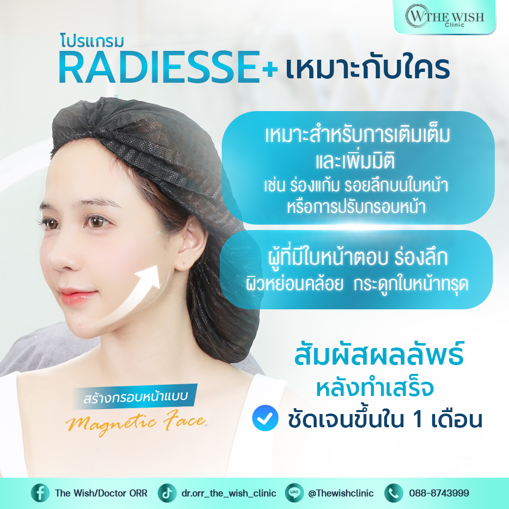 RADIESSE