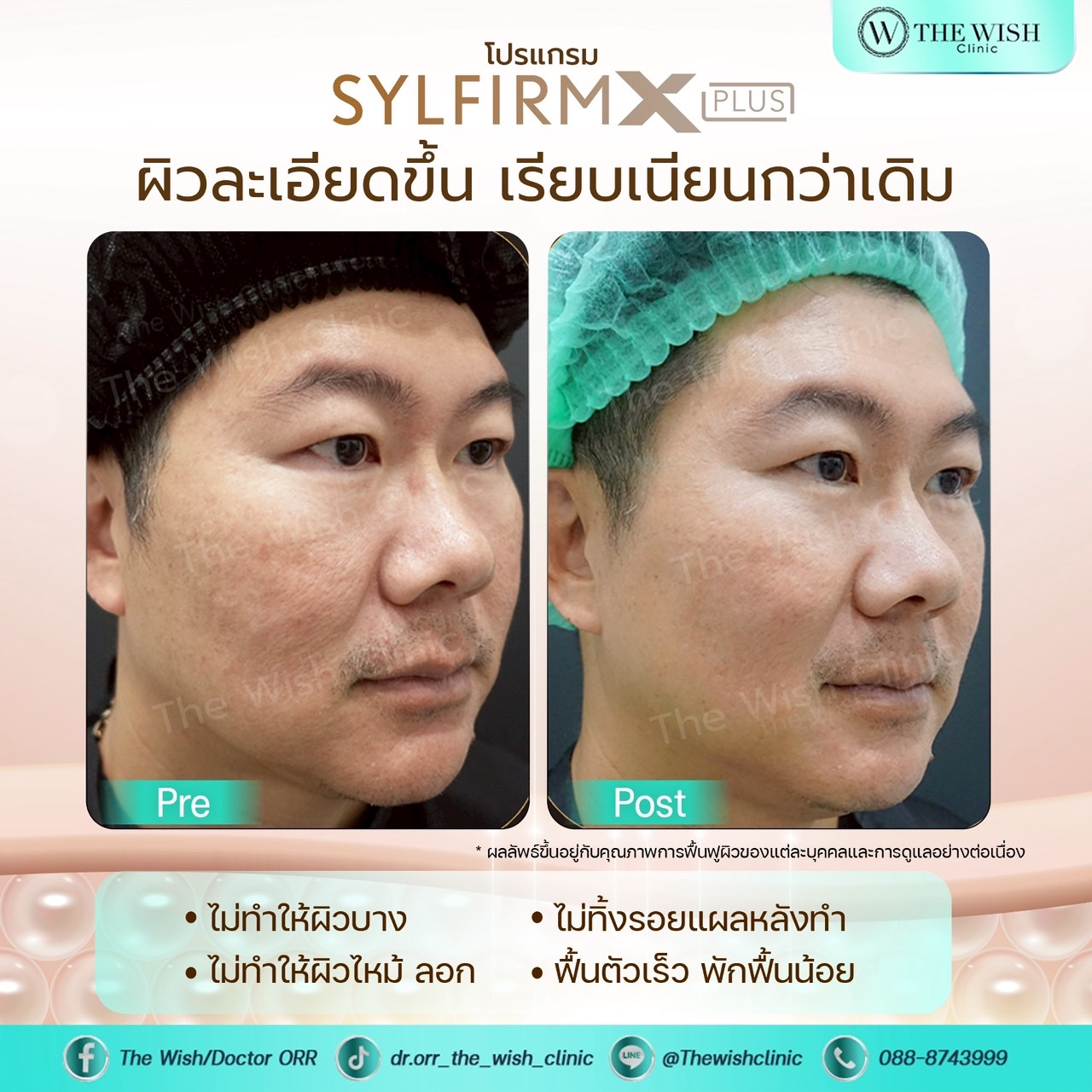 sylfirm