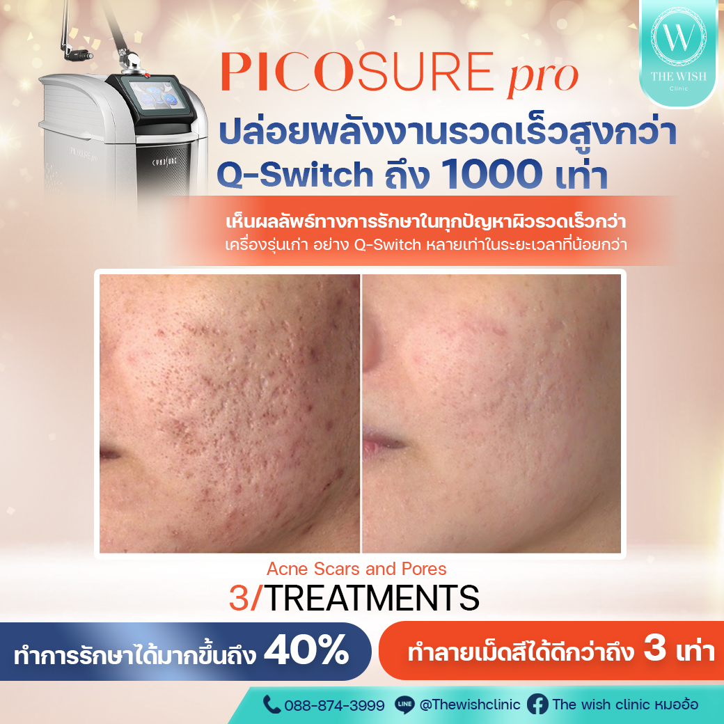 picosure pro