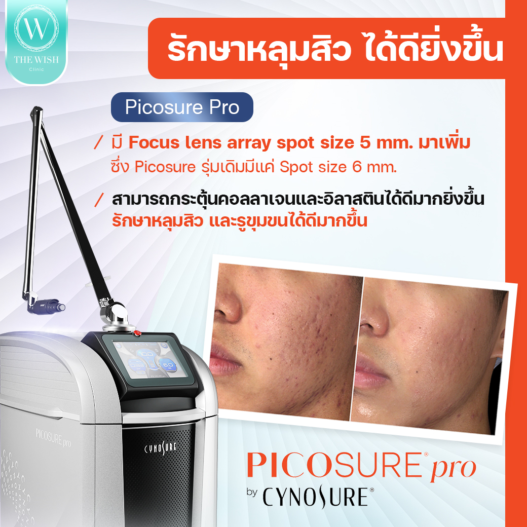 picosure pro