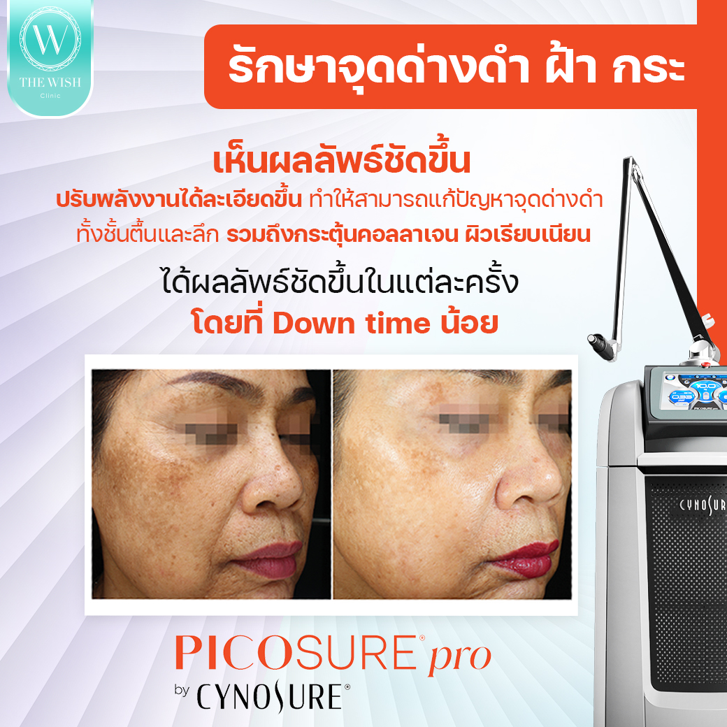 picosure pro