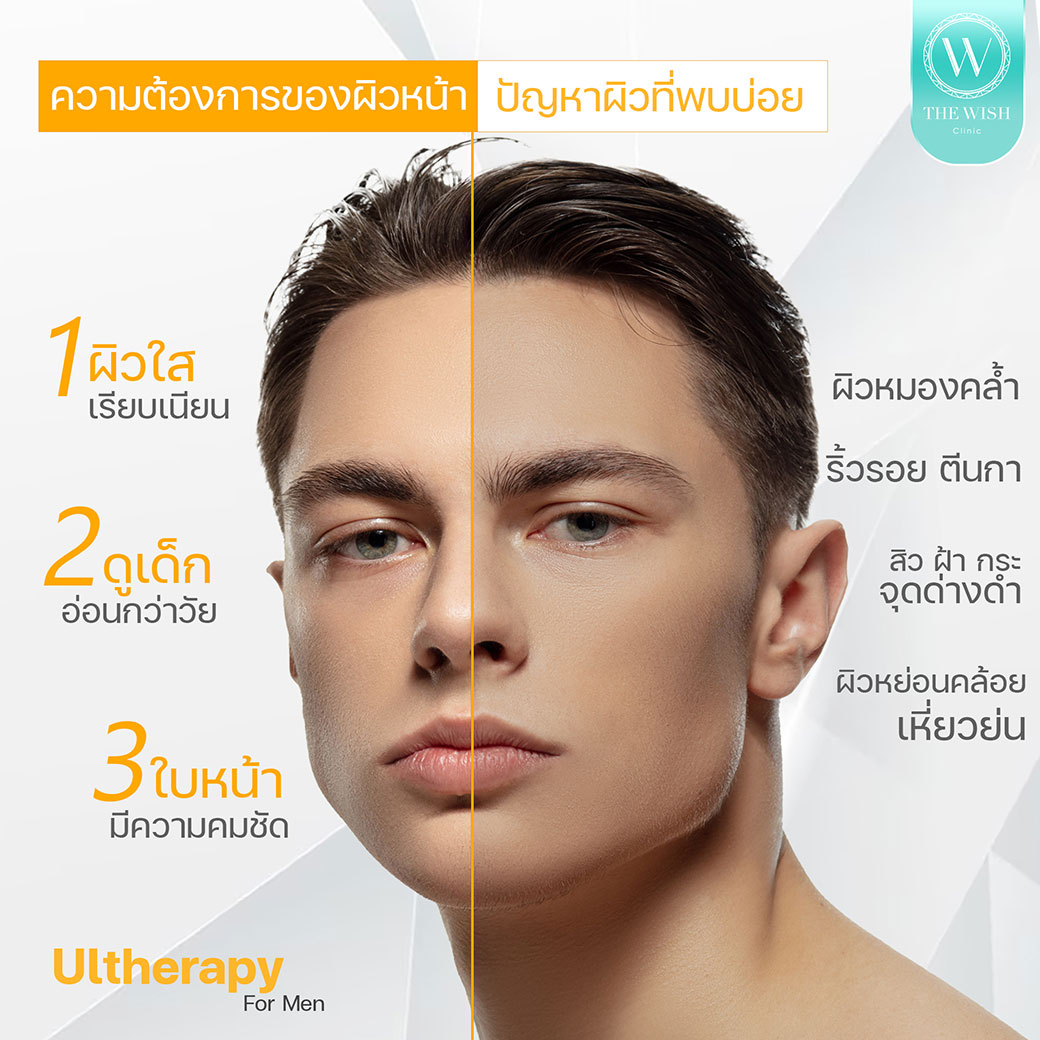 ultherapy