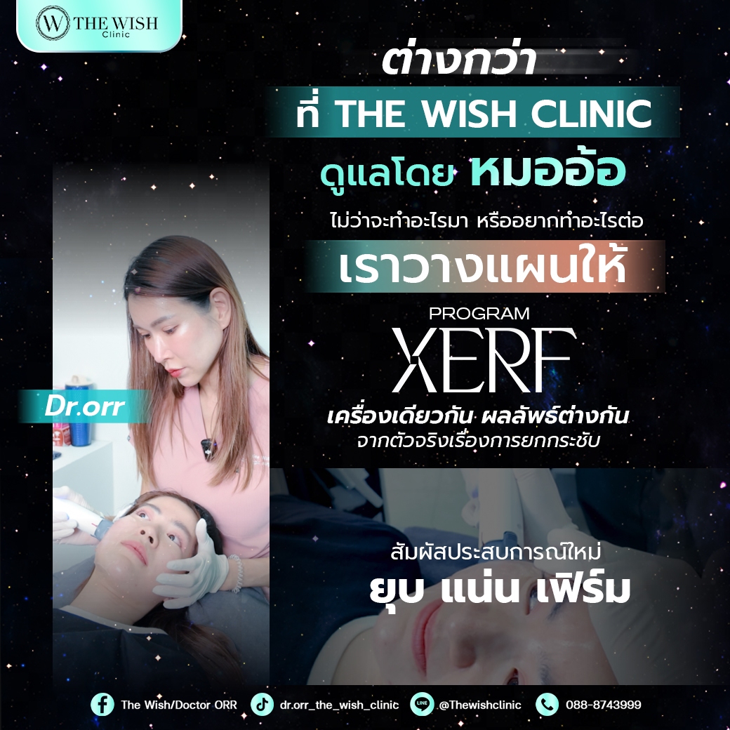 XERF